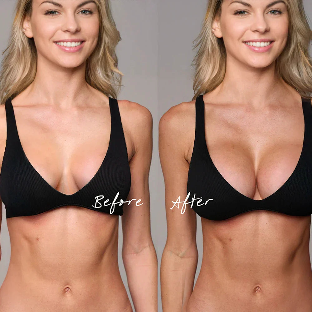 Invisible Lift Inserts